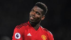 Manchester United's Paul Pogba faces surgery, out for 3-4 weeks